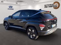 Daumennagel 5 - Hyundai KONA Hybrid Trend 2WD LED, KAMERA, NAVI, GRA, SHZ