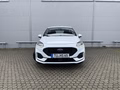 Daumennagel 2 - Ford Fiesta ST-Line