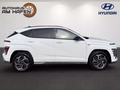 Daumennagel 3 - Hyundai KONA N Line 2WD, SHZ, GRA, KLIMA, KAMERA