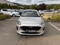 Daumennagel 2 - Ford Fiesta 1.1 Cool & Connect Navi/RFK/LED