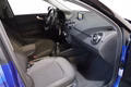 Daumennagel 12 - Audi A1 Sportback 1.0 TFSI ultra S line NAVI SHZ GRA