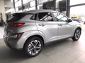 Daumennagel 4 - Hyundai KONA Elektro 100kW incl. 11kW OBC ADVANTAGE Paket Sitzheizung / Multifunktionslenkrad / Navi