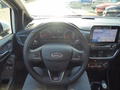 Daumennagel 12 - Ford Fiesta ST